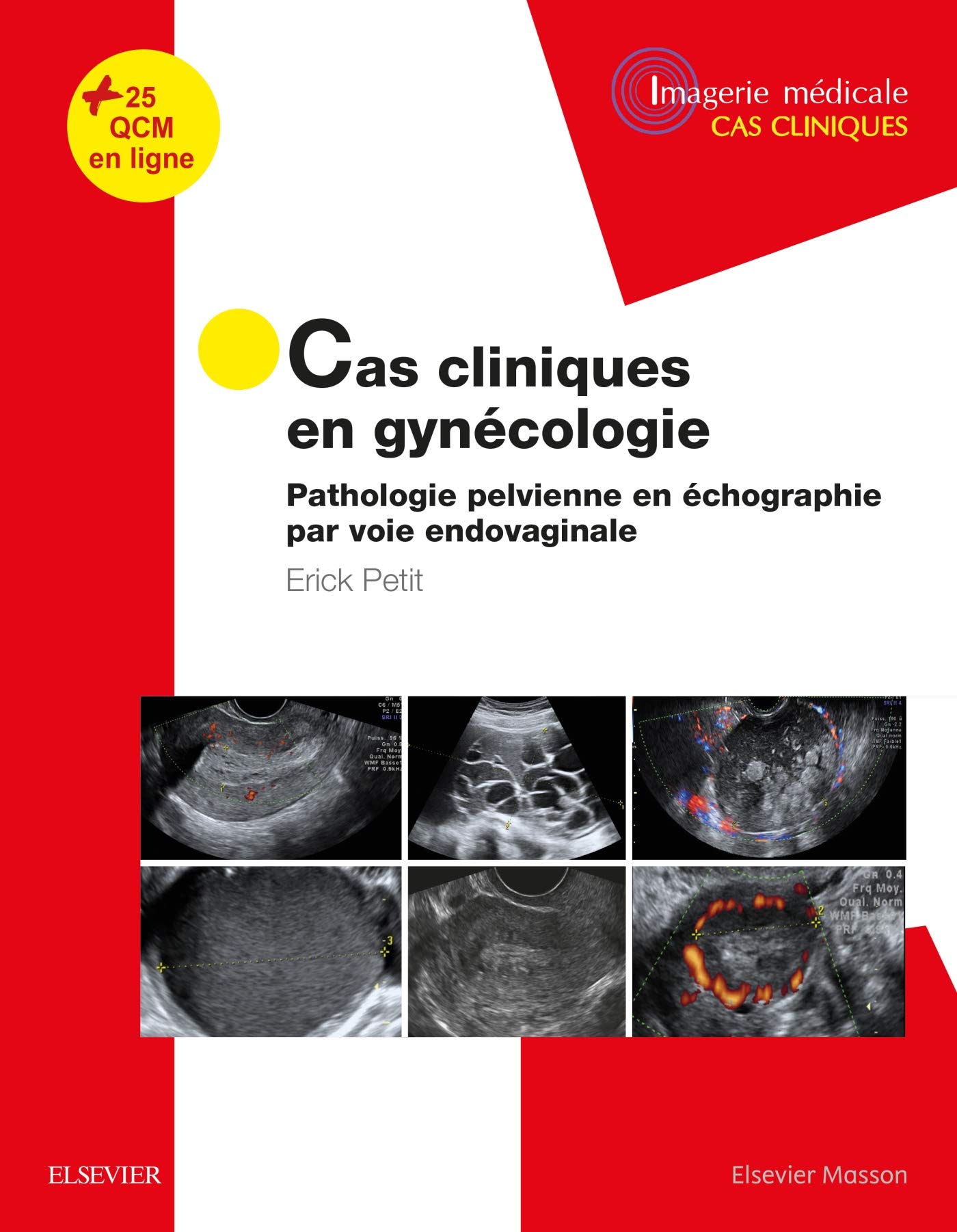 Cas cliniques en imagerie - gynécologie