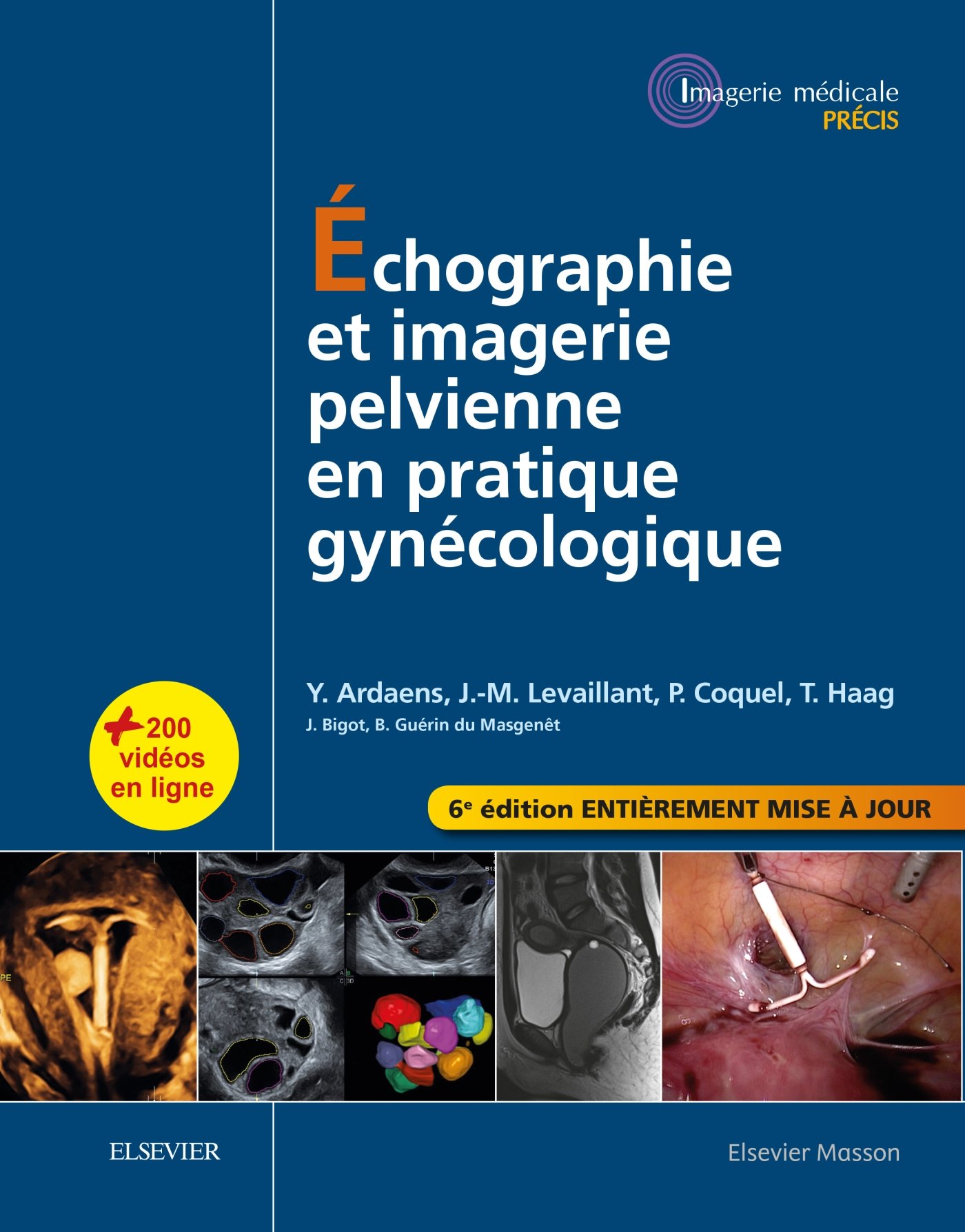 Echographie et imagerie pelvienne en pratique gynécologique 6e